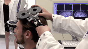 Northwestern news brain stimulation