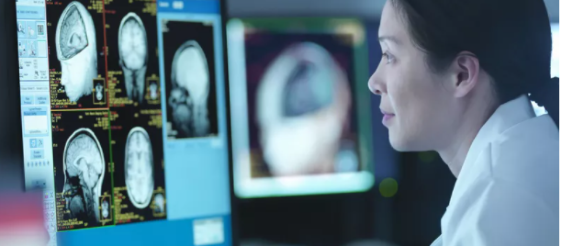 Brain Stimulation Can Be Individualized to Treat Depression