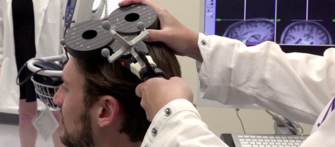 Northwestern news, brain stimulation